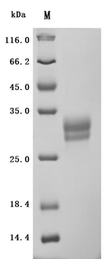 (Tris-Glycine gel) Discontinuous SDS-PAGE (reduced) with 5% enrichment gel and 15% separation gel.