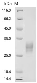 (Tris-Glycine gel) Discontinuous SDS-PAGE (reduced) with 5% enrichment gel and 15% separation gel.