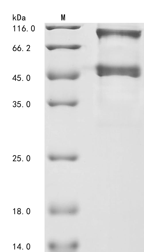 (Tris-Glycine gel) Discontinuous SDS-PAGE (reduced) with 5% enrichment gel and 15% separation gel.