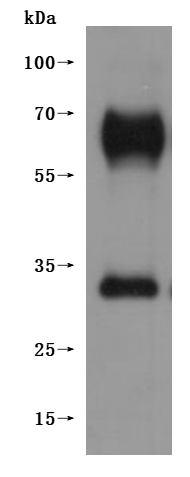CSB-MP5431MOV is detected by Mouse anti-6*His monoclonal antibody.(This tag can be tested only under denaturing conditions.)