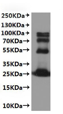 CSB-MP5518MO is detected by Mouse anti-6*His monoclonal antibody.