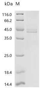 (Tris-Glycine gel) Discontinuous SDS-PAGE (reduced) with 5% enrichment gel and 15% separation gel.