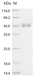 (Tris-Glycine gel) Discontinuous SDS-PAGE (reduced) with 5% enrichment gel and 15% separation gel.
