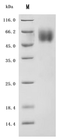 (Tris-Glycine gel) Discontinuous SDS-PAGE (reduced) with 5% enrichment gel and 15% separation gel.