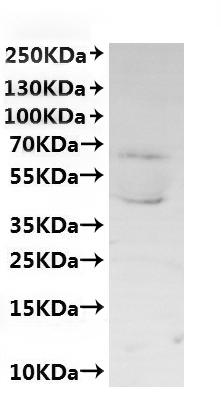 CSB-MP6057CXP1 is detected by Mouse anti-6*His monoclonal antibody.