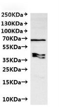 CSB-MP6057CXP(M1) is detected by Mouse anti-6*His monoclonal antibody.