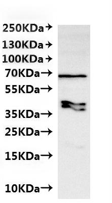 CSB-MP6057CXP(M1) is detected by Mouse anti-6*His monoclonal antibody.