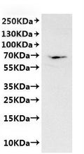 CSB-MP6057CXP(M) is detected by Mouse anti-6*His monoclonal antibody.