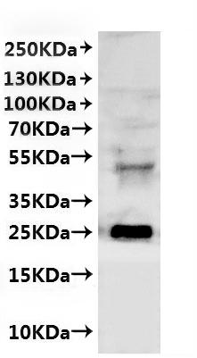 CSB-MP6061GYI is detected by Mouse anti-6*His monoclonal antibody.