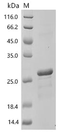 (Tris-Glycine gel) Discontinuous SDS-PAGE (reduced) with 5% enrichment gel and 15% separation gel.