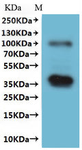 CSB-MP613581HU(A5) is detected by Mouse anti-6*His monoclonal antibody.