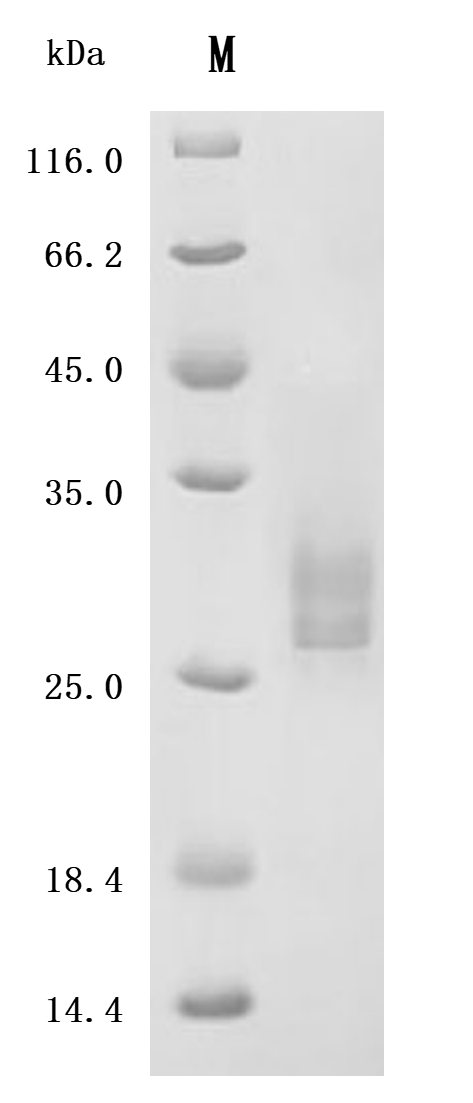 (Tris-Glycine gel) Discontinuous SDS-PAGE (reduced) with 5% enrichment gel and 15% separation gel.
