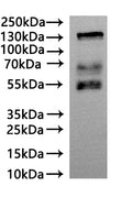CSB-MP619082HU(A4) is detected by Mouse anti-6*His monoclonal antibody.