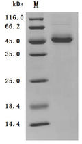 (Tris-Glycine gel) Discontinuous SDS-PAGE (reduced) with 5% enrichment gel and 15% separation gel.