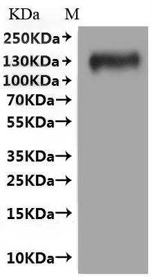 CSB-MP621688HU(A5)(M)  is detected by Mouse anti-6*His monoclonal antibody.
