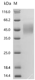 (Tris-Glycine gel) Discontinuous SDS-PAGE (reduced) with 5% enrichment gel and 15% separation gel.