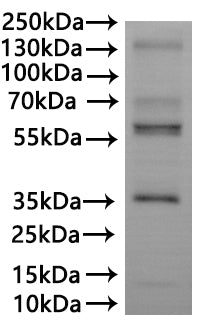 CSB-MP622766HU is detected by Mouse anti-6*His monoclonal antibody