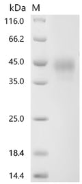 (Tris-Glycine gel) Discontinuous SDS-PAGE (reduced) with 5% enrichment gel and 15% separation gel.