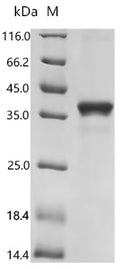 (Tris-Glycine gel) Discontinuous SDS-PAGE (reduced) with 5% enrichment gel and 15% separation gel.