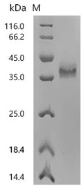 (Tris-Glycine gel) Discontinuous SDS-PAGE (reduced) with 5% enrichment gel and 15% separation gel.
