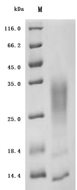 (Tris-Glycine gel) Discontinuous SDS-PAGE (reduced) with 5% enrichment gel and 15% separation gel.