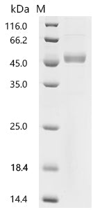 (Tris-Glycine gel) Discontinuous SDS-PAGE (reduced) with 5% enrichment gel and 15% separation gel.