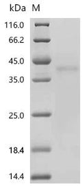 (Tris-Glycine gel) Discontinuous SDS-PAGE (reduced) with 5% enrichment gel and 15% separation gel.