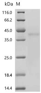 (Tris-Glycine gel) Discontinuous SDS-PAGE (reduced) with 5% enrichment gel and 15% separation gel.
