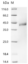 (Tris-Glycine gel) Discontinuous SDS-PAGE (reduced) with 5% enrichment gel and 15% separation gel.