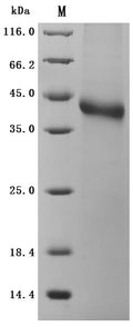 (Tris-Glycine gel) Discontinuous SDS-PAGE (reduced) with 5% enrichment gel and 15% separation gel.
