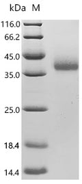 (Tris-Glycine gel) Discontinuous SDS-PAGE (reduced) with 5% enrichment gel and 15% separation gel.