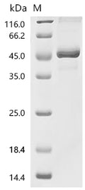 (Tris-Glycine gel) Discontinuous SDS-PAGE (reduced) with 5% enrichment gel and 15% separation gel.