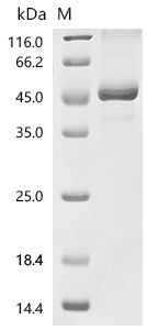 (Tris-Glycine gel) Discontinuous SDS-PAGE (reduced) with 5% enrichment gel and 15% separation gel.