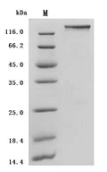 (Tris-Glycine gel) Discontinuous SDS-PAGE (reduced) with 5% enrichment gel and 15% separation gel.