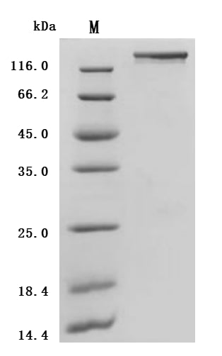 (Tris-Glycine gel) Discontinuous SDS-PAGE (reduced) with 5% enrichment gel and 15% separation gel.