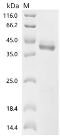 (Tris-Glycine gel) Discontinuous SDS-PAGE (reduced) with 5% enrichment gel and 15% separation gel.