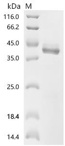 (Tris-Glycine gel) Discontinuous SDS-PAGE (reduced) with 5% enrichment gel and 15% separation gel.