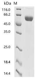 (Tris-Glycine gel) Discontinuous SDS-PAGE (reduced) with 5% enrichment gel and 15% separation gel.