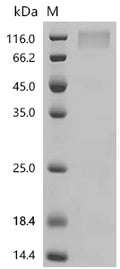(Tris-Glycine gel) Discontinuous SDS-PAGE (reduced) with 5% enrichment gel and 15% separation gel.