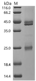 (Tris-Glycine gel) Discontinuous SDS-PAGE (reduced) with 5% enrichment gel and 15% separation gel.