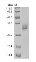(Tris-Glycine gel) Discontinuous SDS-PAGE (reduced) with 5% enrichment gel and 15% separation gel.