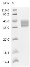 CSB-MP009316HU is detected by Mouse anti-6*His monoclonal antibody