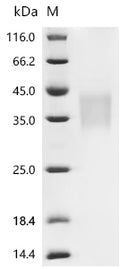 (Tris-Glycine gel) Discontinuous SDS-PAGE (reduced) with 5% enrichment gel and 15% separation gel.