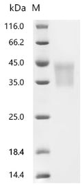 (Tris-Glycine gel) Discontinuous SDS-PAGE (reduced) with 5% enrichment gel and 15% separation gel.