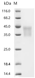 (Tris-Glycine gel) Discontinuous SDS-PAGE (reduced) with 5% enrichment gel and 15% separation gel.