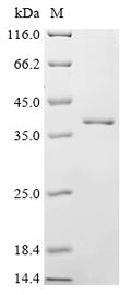 (Tris-Glycine gel) Discontinuous SDS-PAGE (reduced) with 5% enrichment gel and 15% separation gel.