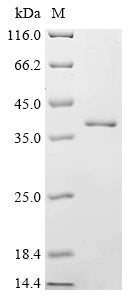 (Tris-Glycine gel) Discontinuous SDS-PAGE (reduced) with 5% enrichment gel and 15% separation gel.