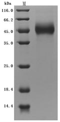 (Tris-Glycine gel) Discontinuous SDS-PAGE (reduced) with 5% enrichment gel and 15% separation gel.