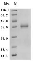 (Tris-Glycine gel) Discontinuous SDS-PAGE (reduced) with 5% enrichment gel and 15% separation gel.