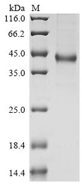 (Tris-Glycine gel) Discontinuous SDS-PAGE (reduced) with 5% enrichment gel and 15% separation gel.